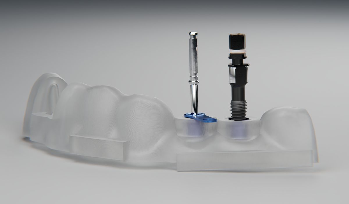 Guía quirúrgica impresa en 3D con fresa e implante dental