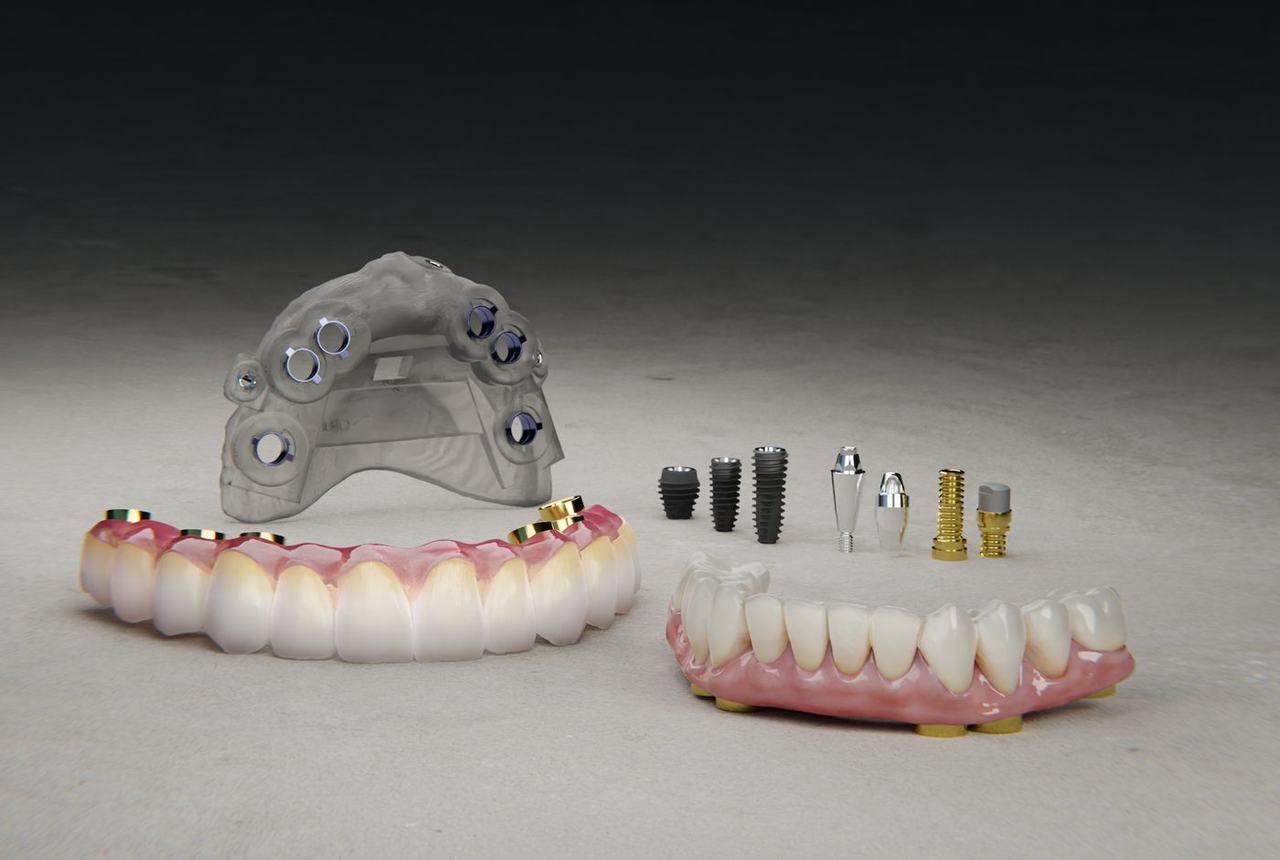 Implantes dentales y prótesis fija sobre implantes en Medellín